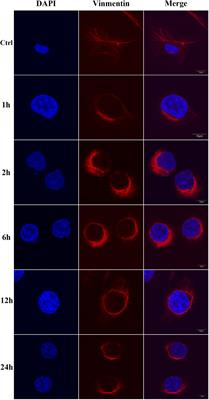 Vimentin Inhibits Dengue Virus Type 2 Invasion of the Blood-Brain Barrier